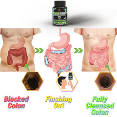 STOMACH CLEANSER- Colon Cleanse Ayurvedic Supplement | Helps Get Rid Of Toxins & Constipation | 100% Natural