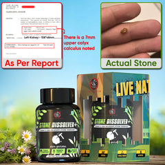 STONE DISSOLVER+ Ayurvedic Stone Remover Supplement | Relieves Pain, Breaks All Types Of Stones, Fast Acting | 100% Natural